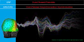 Event Related Potentials